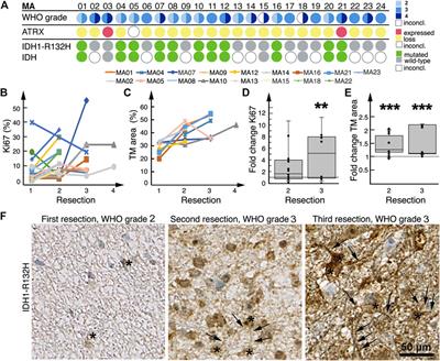 Progression Patterns in Non-Contrast-Enhancing Gliomas Support Brain Tumor Responsiveness to Surgical Lesions